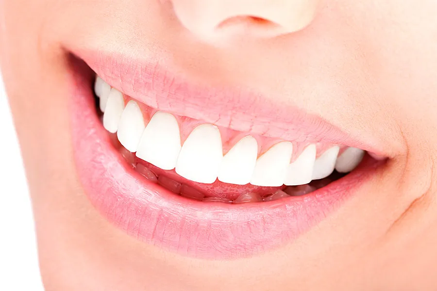 Sonrisa con dientes blancos