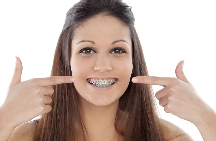 Mujer señalando sus brackets